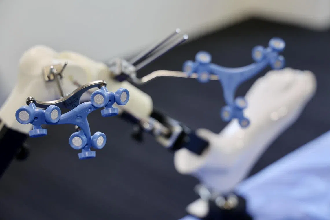 亚历山大医院骨科手术顾问医生廖子强受访时说，膝关节非常灵活，可往多个方向转动，术前静态成像无法全方位地呈现每位病患膝盖的结构细节，传统方法须要医生在手术进行过程中，临场手动调整假体植入的准确位置和角度。（陈斌勤摄）