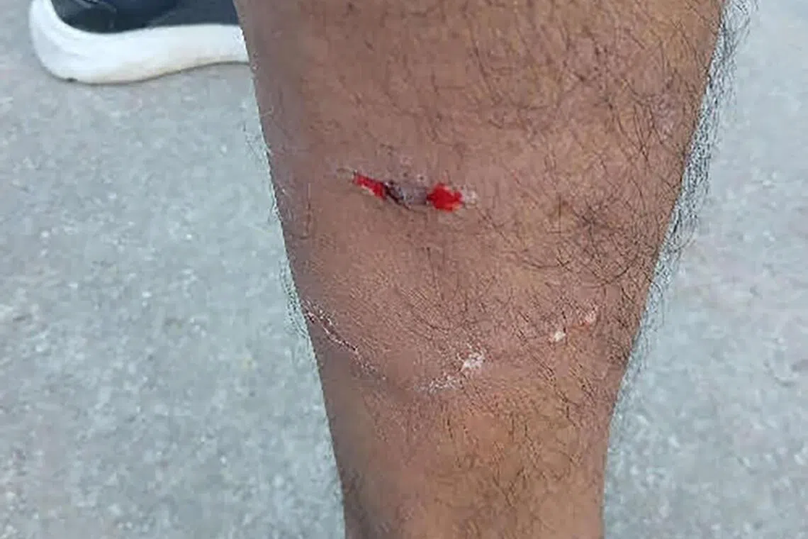 2025年5月25日。一名受害人骑脚踏车经过实里达西8农道，三只狗从他身后出现，另一只从农场里跑出来追逐并冲他吠叫，其中一只狗还咬伤受害人的右小腿。（动物与兽医事务组提供）