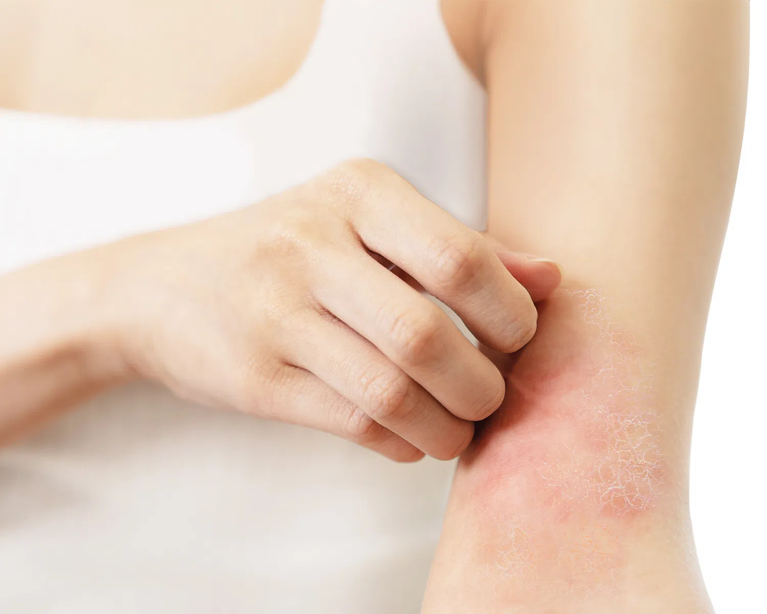 韩国和台湾的研究证实，空气污染与湿疹的发病率有关联。（图/QV提供）