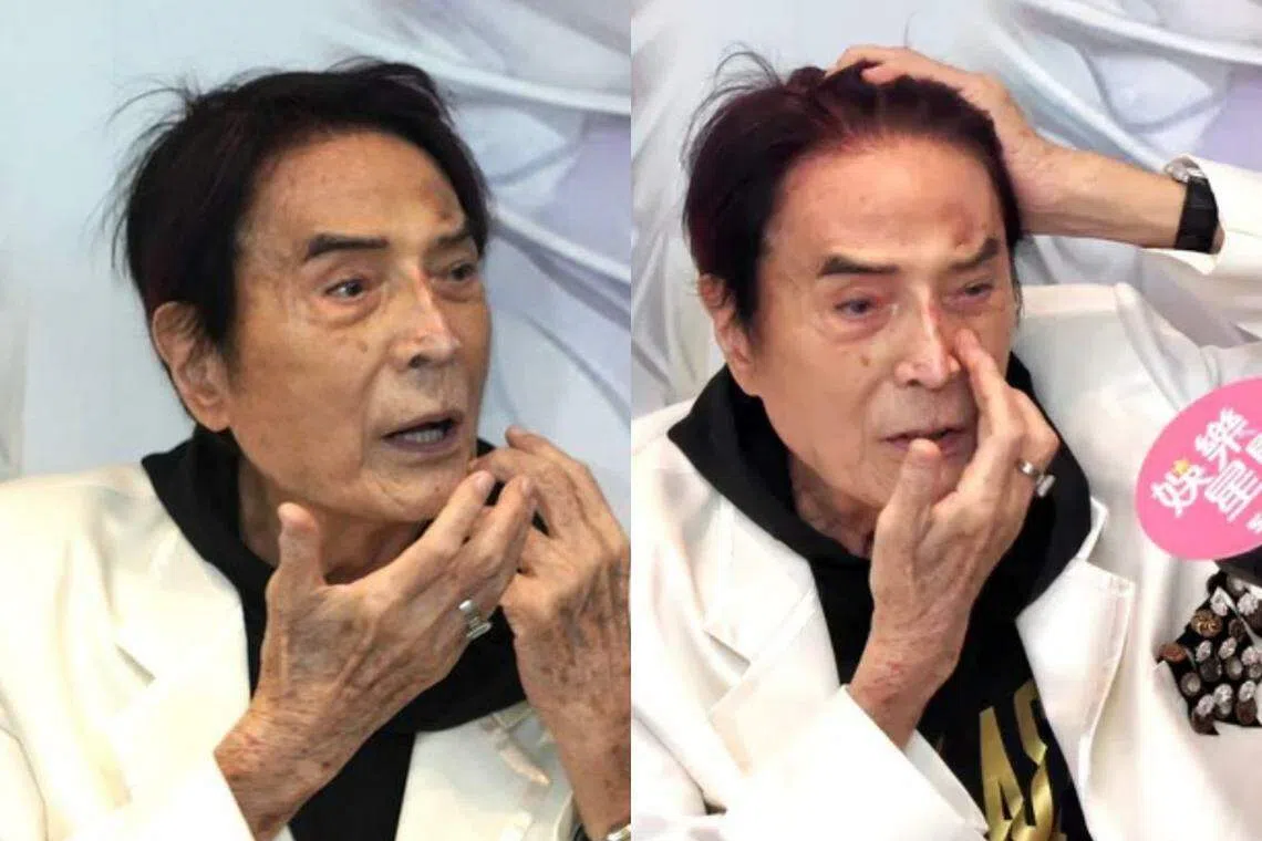 林冲坦言最怕脸上留下伤疤。（互联网）