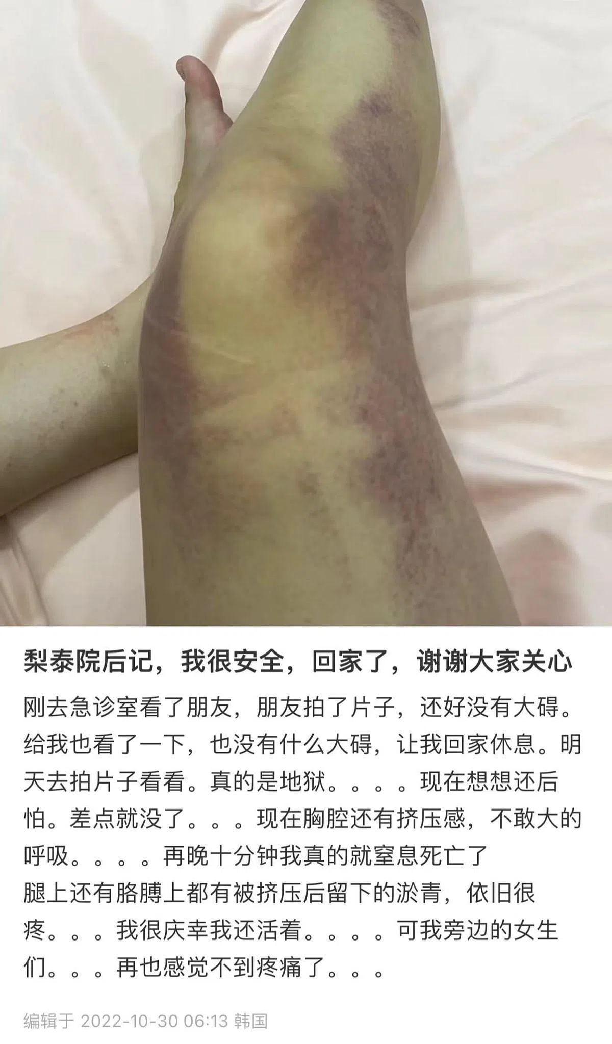 踩踏事故的生还者事后发文忆述事发经过。（小红书截图）