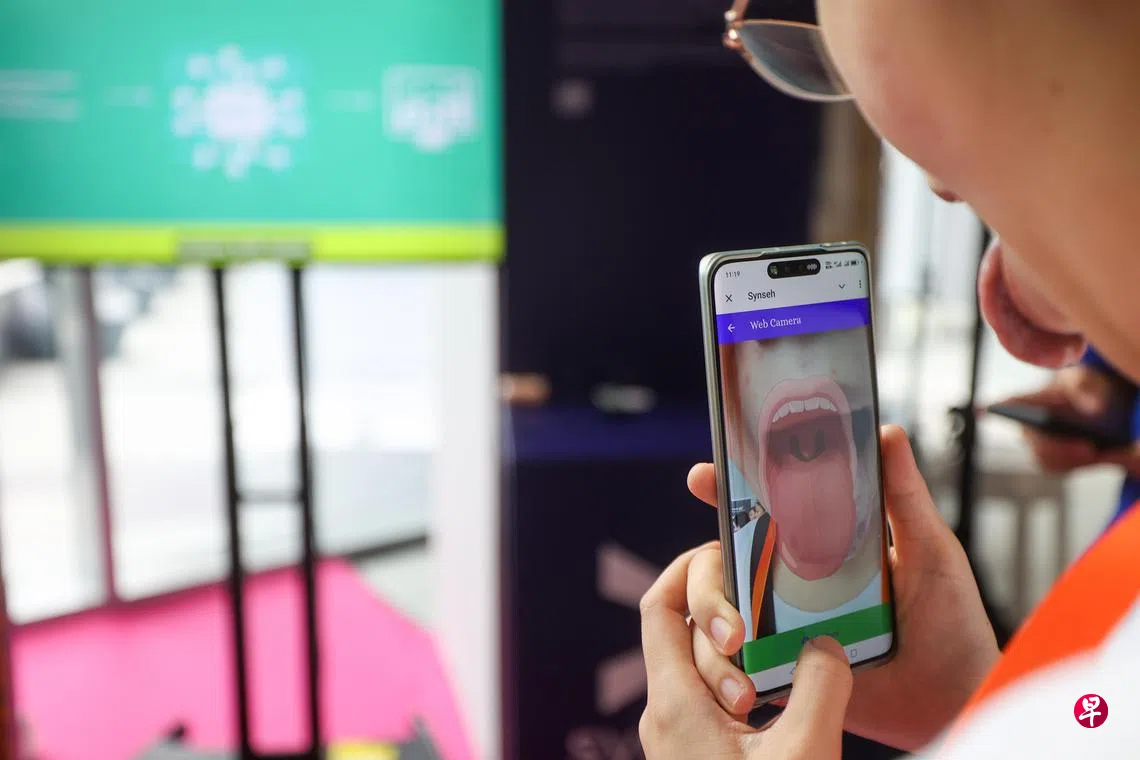 对手机吐舌头就能掌握健康状况人工智能化身中医做舌诊| 联合早报