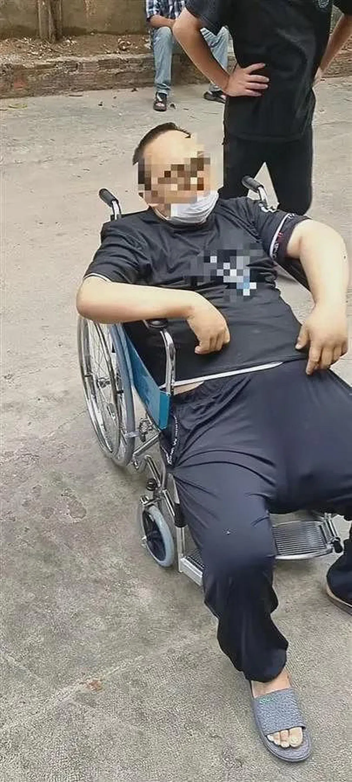 李亚送医救治时，除右臂以外全身极度浮肿，命悬一线。（上游新闻）