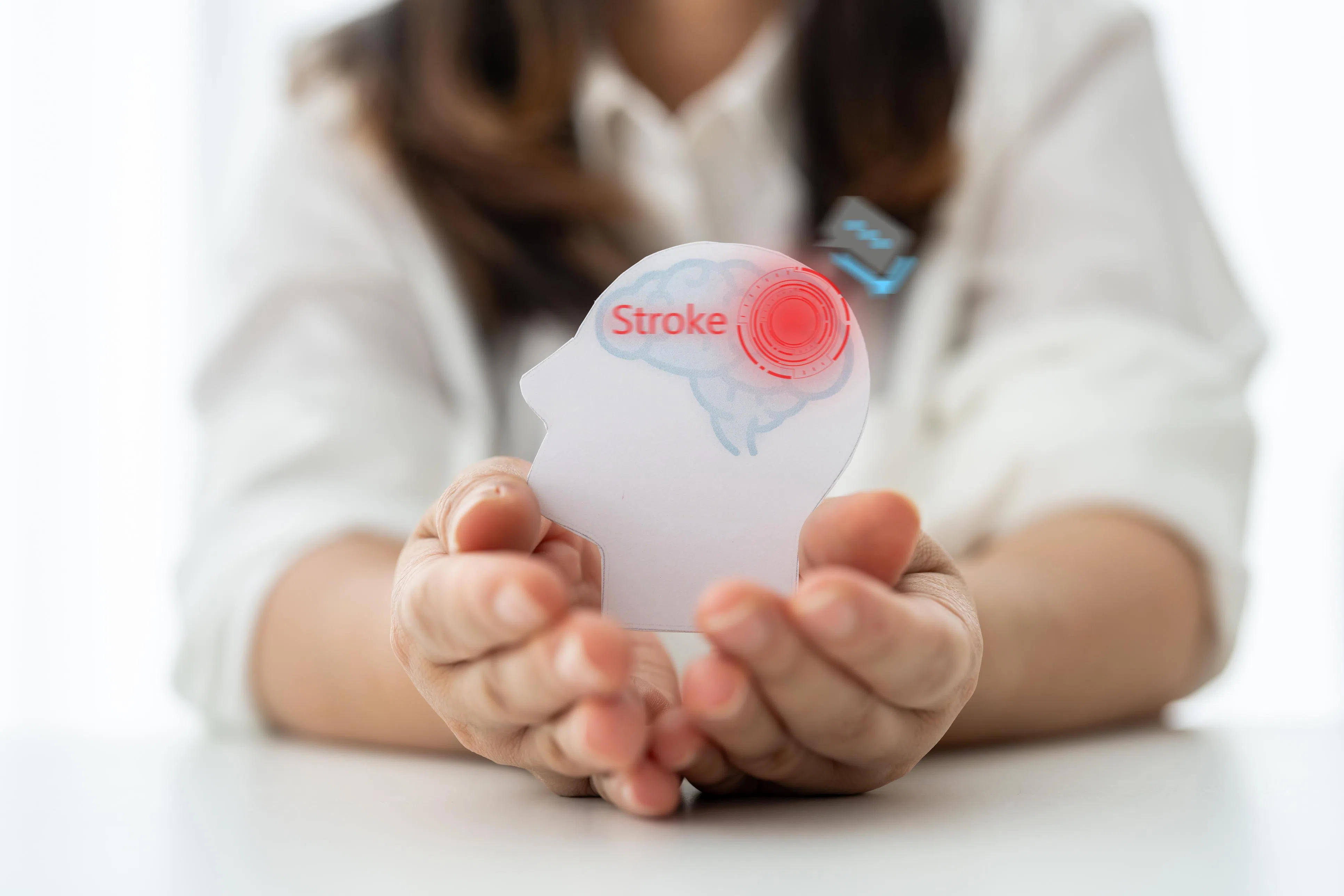 After a mini-stroke, about half of patients will have a stroke within 48 hours, while the risk of a stroke within 90 days is as high as 10–15%.（Photo: iStock）