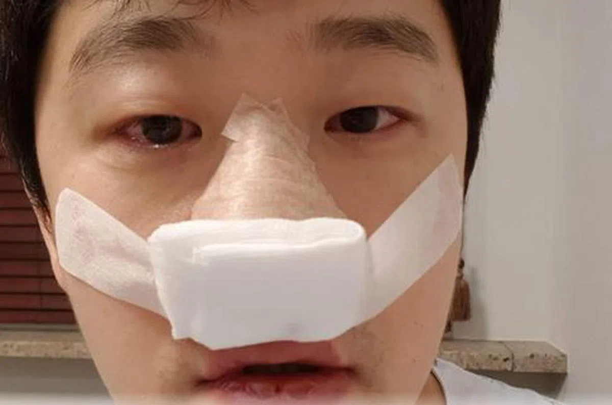 崔圣奉请大家给他支持，不要忘记他。（互联网）
