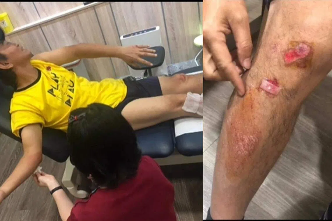 吴宗宪疑似录制节目不慎受伤。（取自吴宗宪脸书）