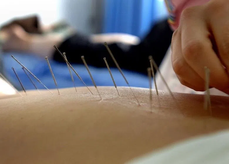 林诗晖说，西医治病主要是治疗看得见的东西，像肿瘤、验血报告、血糖指数等。中医说的穴位、经络、虚、寒等，都是看不到的。（档案照片）