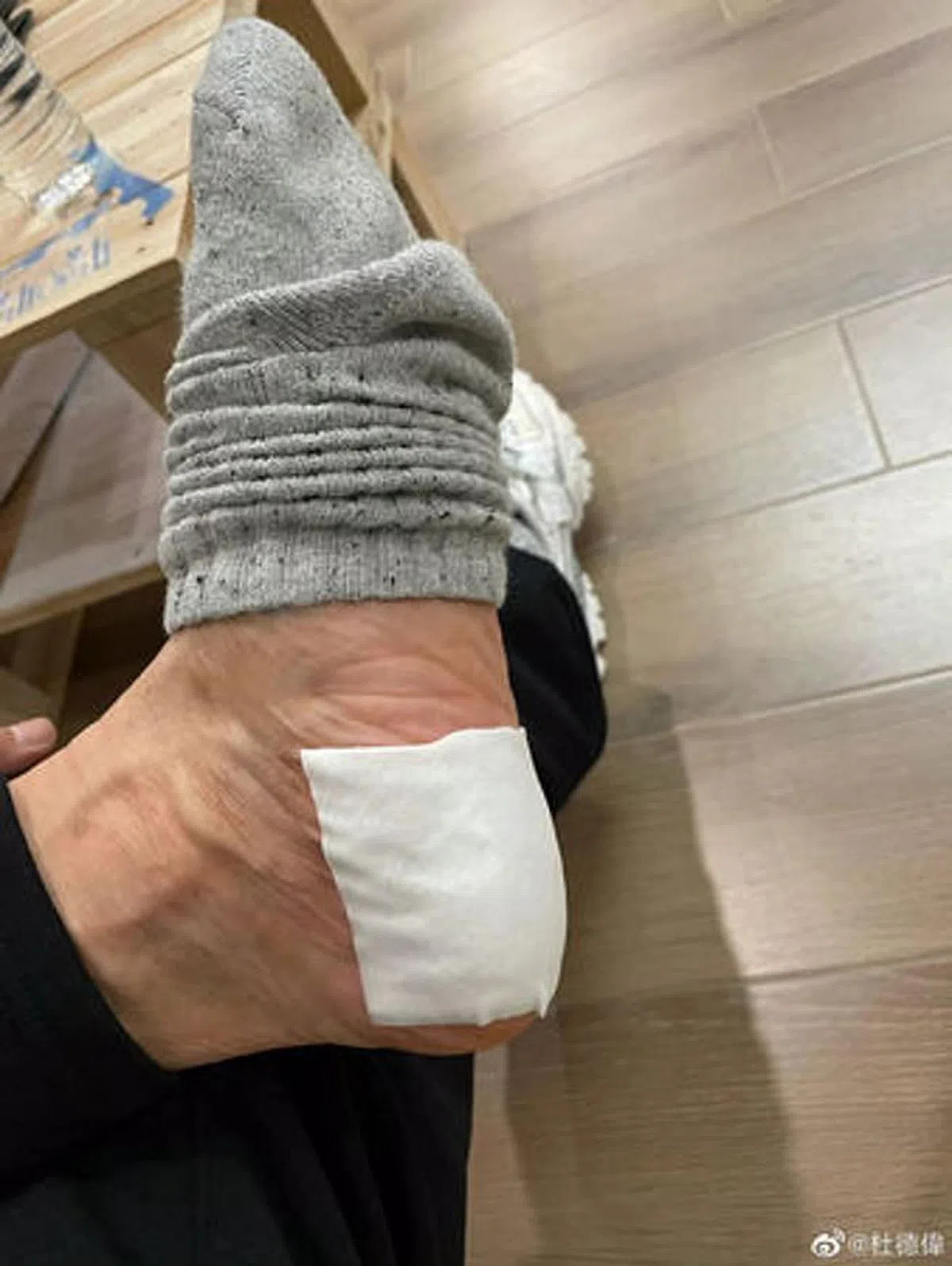 杜德伟在微博上传脚的患处照片。（取自微博）