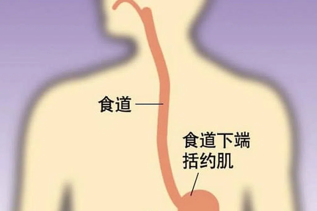 症状像心脏疾病 胃食道逆流难分辨 | 联合早报