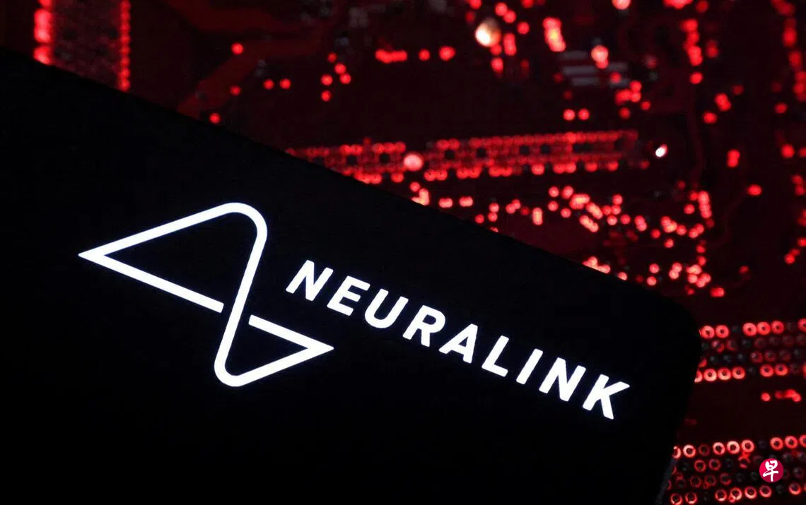 让“意念”操控电脑马斯克2026年将量产脑机接口设备| 联合早报