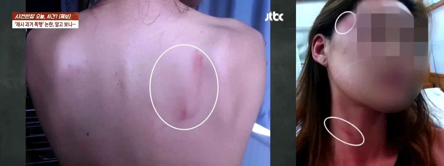 A女称曾在2013年被Jessi及友人打。（互联网）