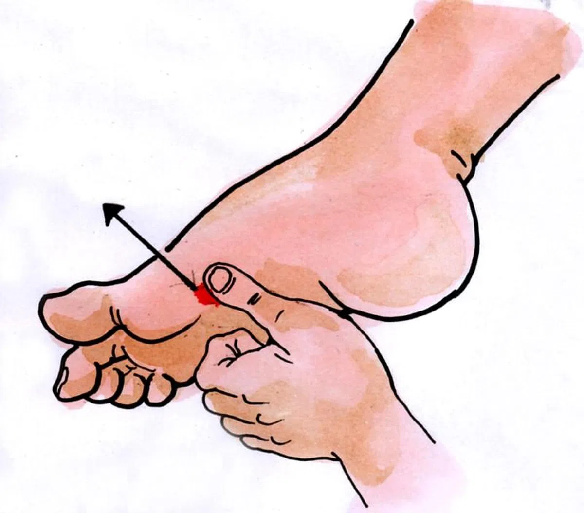 太白穴：在足内侧缘，第一跖骨小头（大拇趾本节）后下方的赤白肉际处。