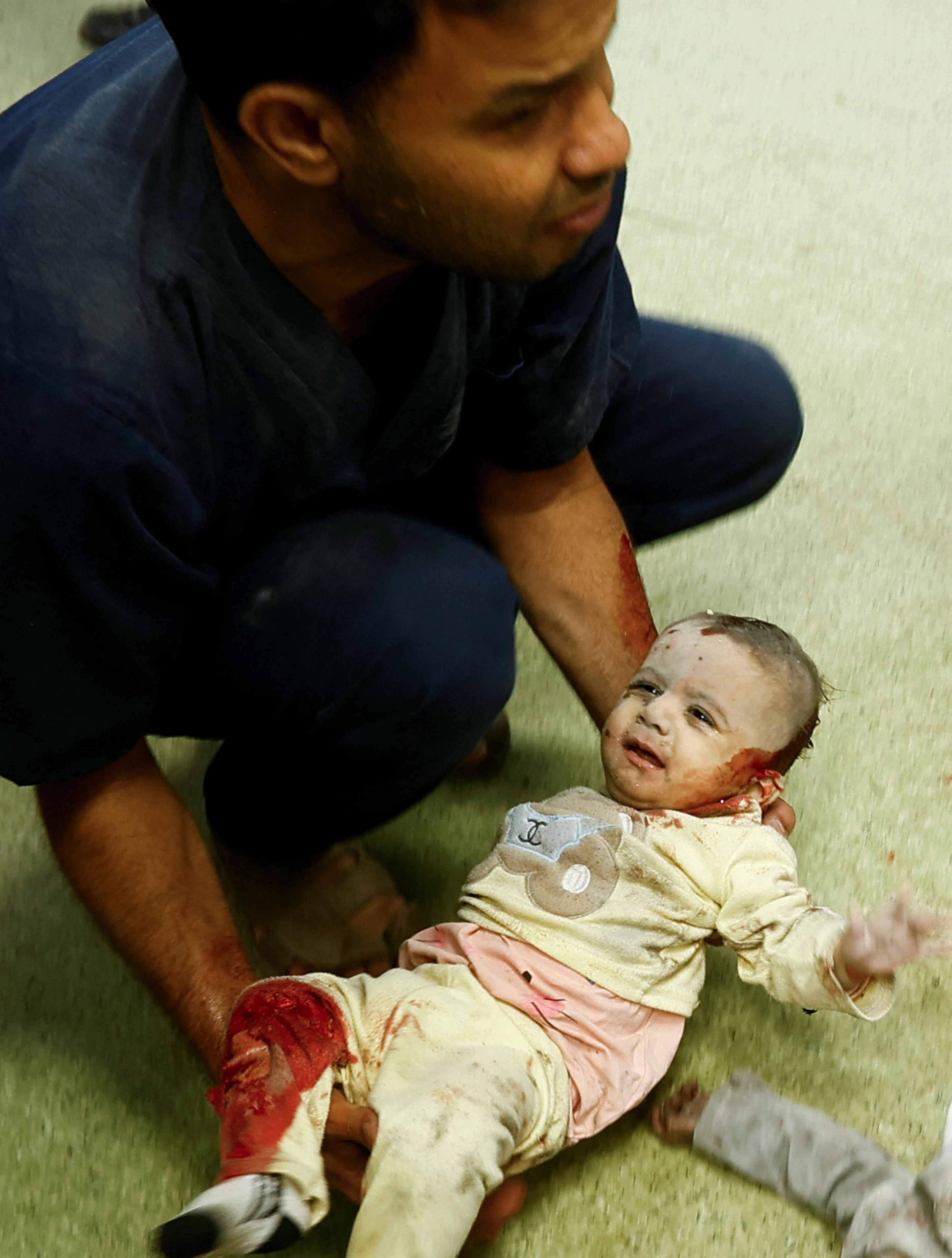 以色列军11月18日袭击加沙地带南部汗尤尼斯（Khan Younis）地区一栋住宅楼，一个受伤的小孩在纳赛尔医院（Nasser hospital）接受治疗。（路透社）