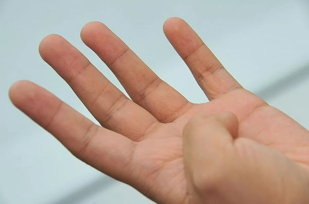 四缝穴。（档案照）