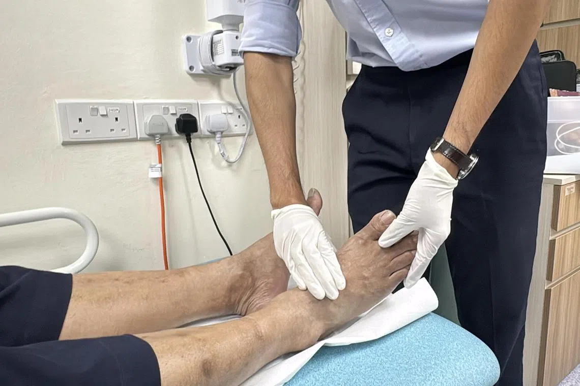 若痛风病情得不到良好控制，会导致关节变形，行动受限，还可能引发肾结石或肾衰竭。（新加坡保健服务集团综合诊疗所提供）