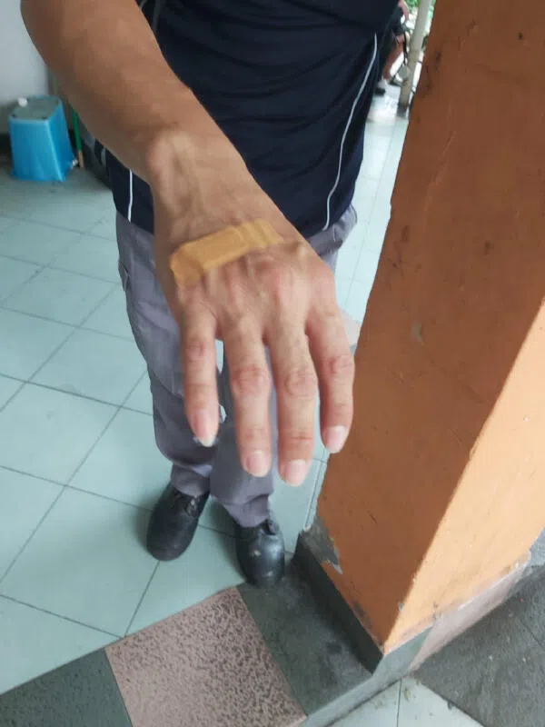  黑色衣服男子手刮伤。（受访者提供）