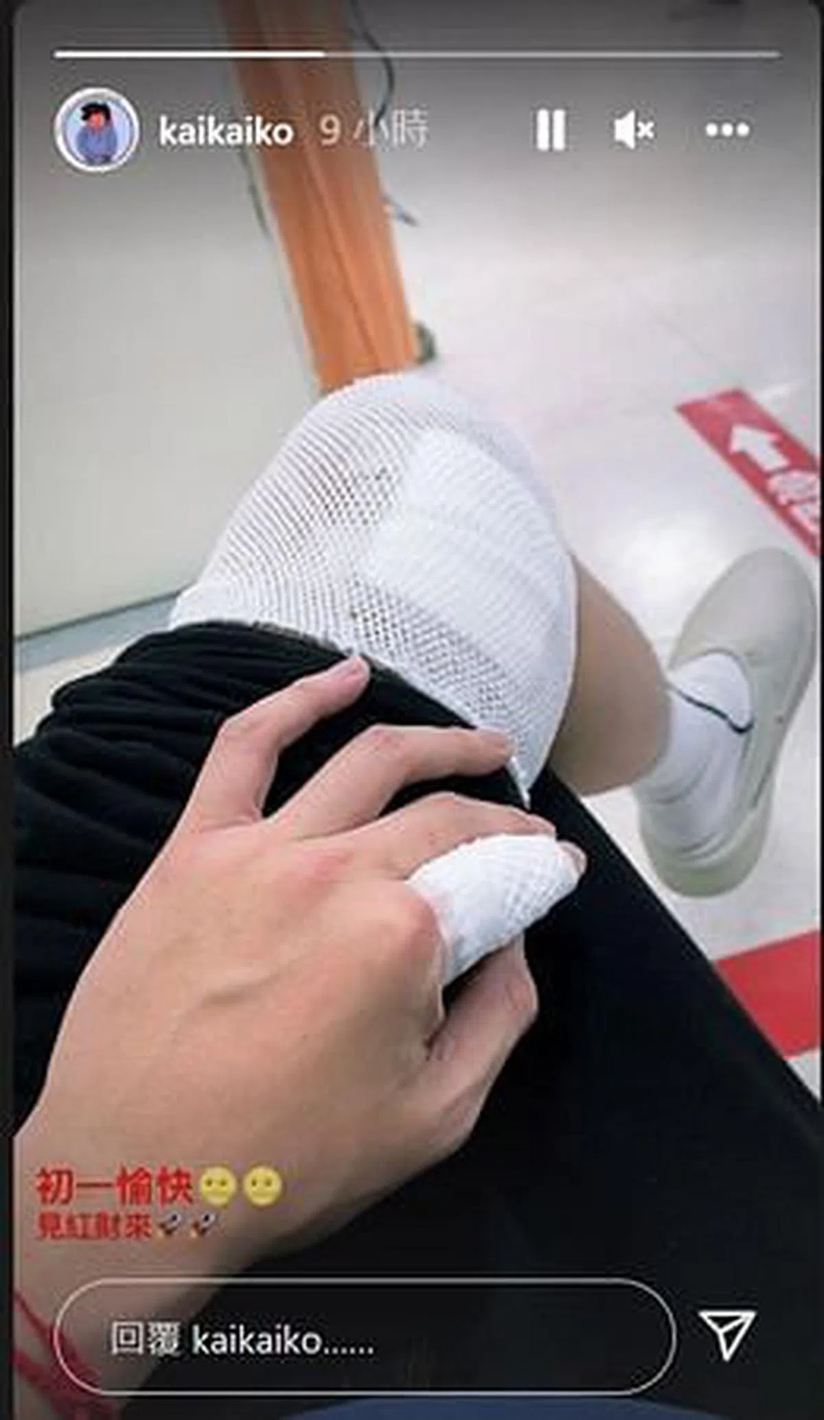 柯震东的伤势似乎不轻。（IG）