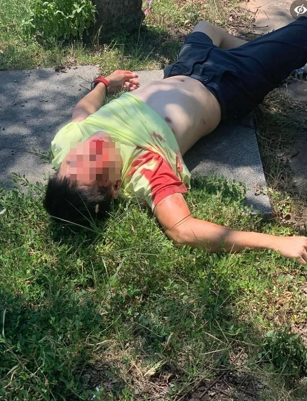 林志颖被拍到受伤的样子。（互联网）