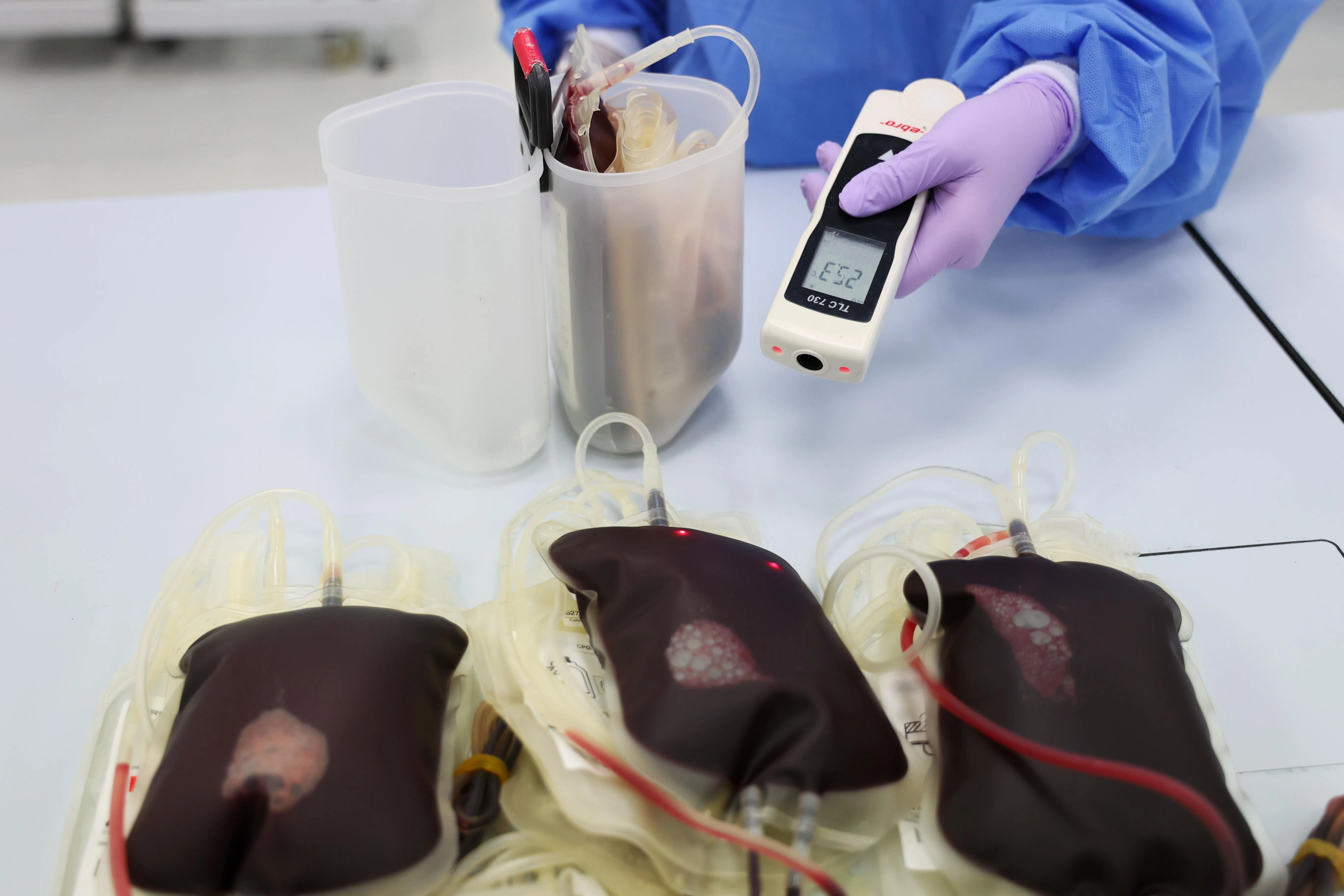 
血液送到卫生科学局后，血液处理实验室的工作人员在开始工作前测量每个血袋的温度，以确保它们都在合适的温度范围内进行下一步操作。（林明顺摄）