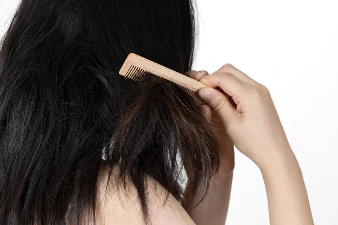 枯燥易断的毛发，宜选用性质温和的洗发乳。（iStock图片）