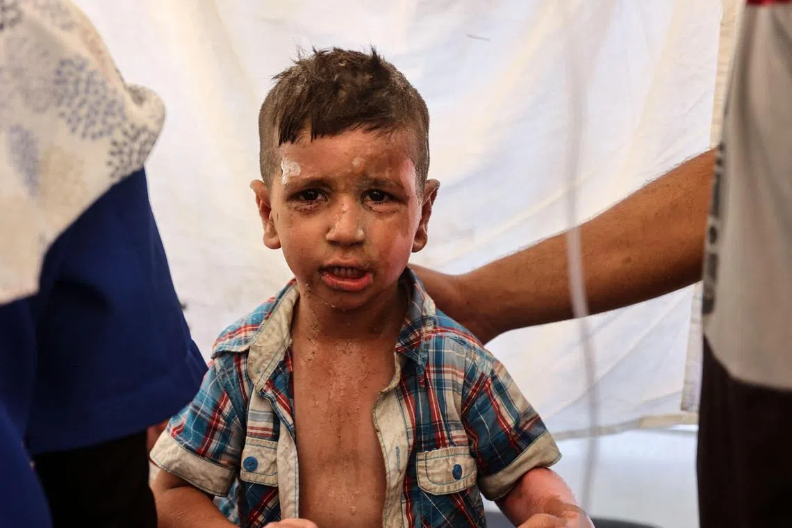 8月8日，加沙市一所巴勒斯坦流离失所者用作避难所的学校遭到以色列空袭，一个男孩在马马达尼（al-Maamadani）医院等待烧伤治疗。（法新社）