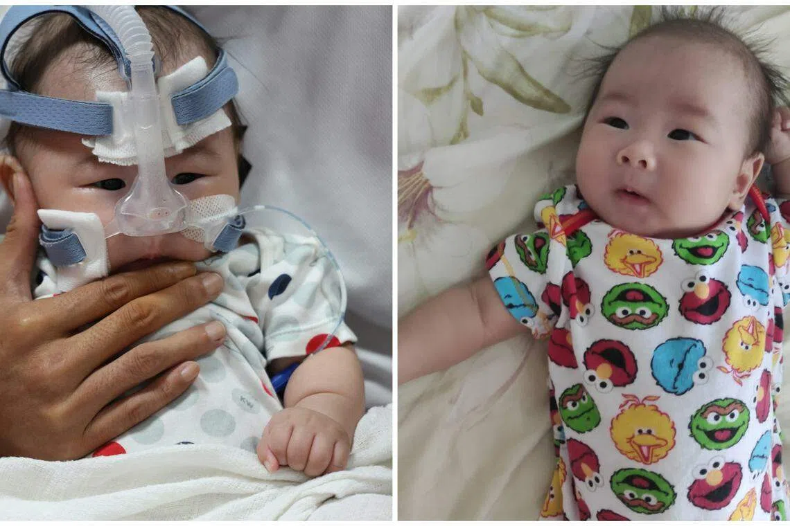 三个月大的王彦喆喜欢跟人互动。如果不说，应该很难看出他不幸患上脊髓性肌萎缩症。（档案照/受访者提供）