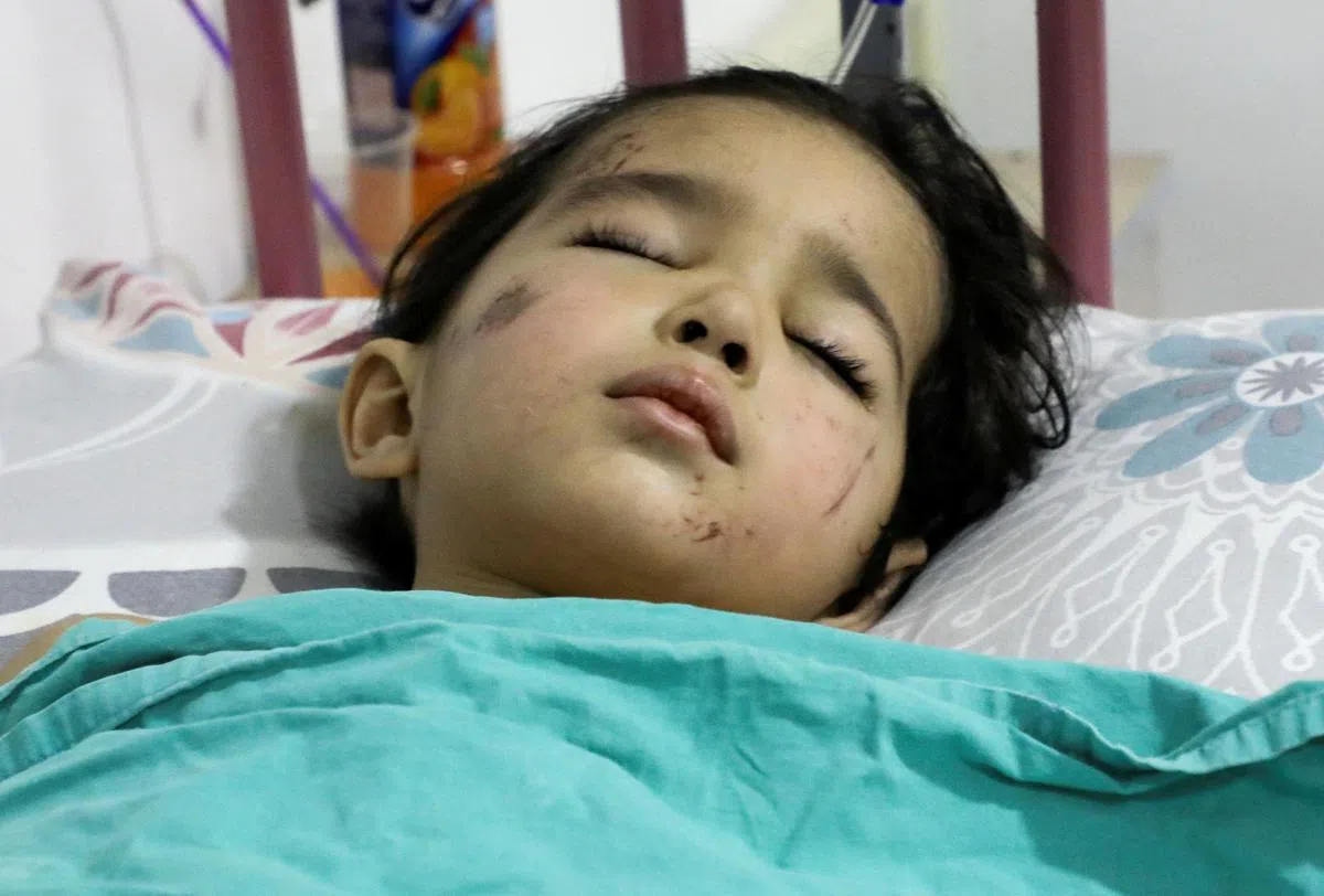 叙利亚3岁幼童海达尔(Tariq Haidar) 侥幸生还，送往医院急救；只是小生命醒过来后，会发现此生没了爸爸妈妈和全家人，以及一条腿。（路透社）