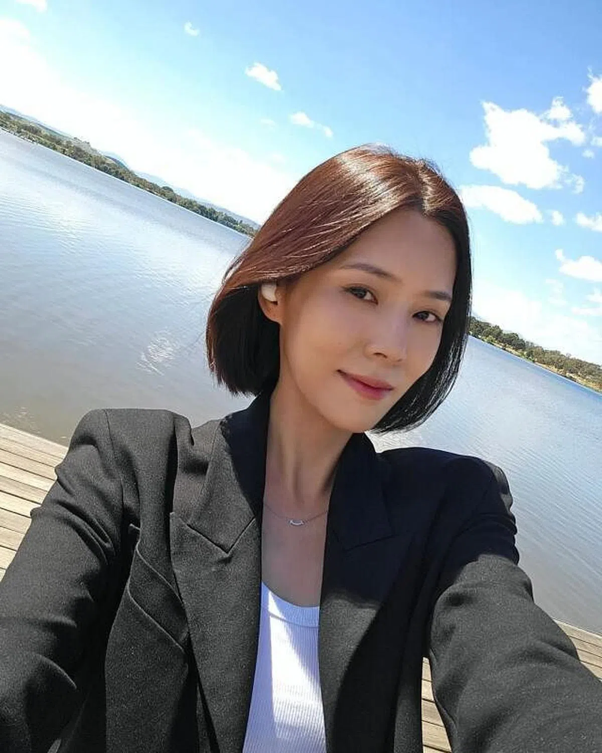 黄思恬自嘲是“特别容易受伤的女人”，拍戏时身体动不动就出现淤青。（取自网络）