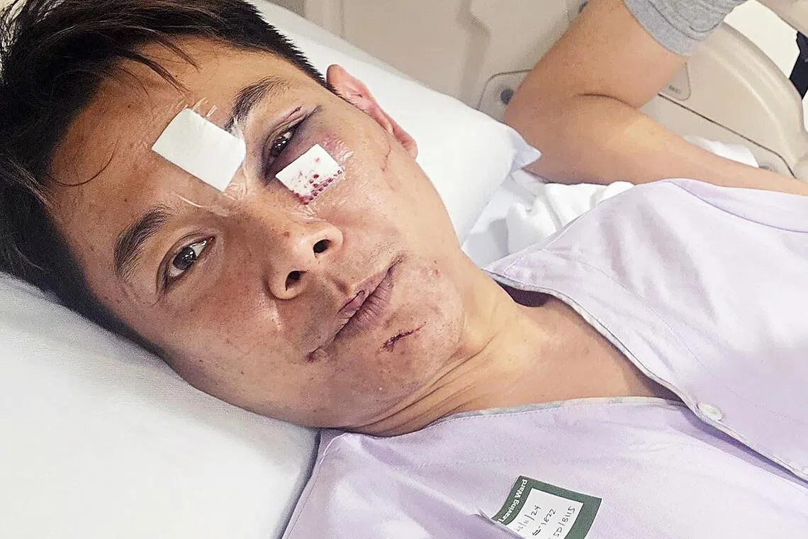 廖永谊左眼眶等脸部多处骨折，左额、右面颊、左耳等多处也有裂伤。（档案照片）