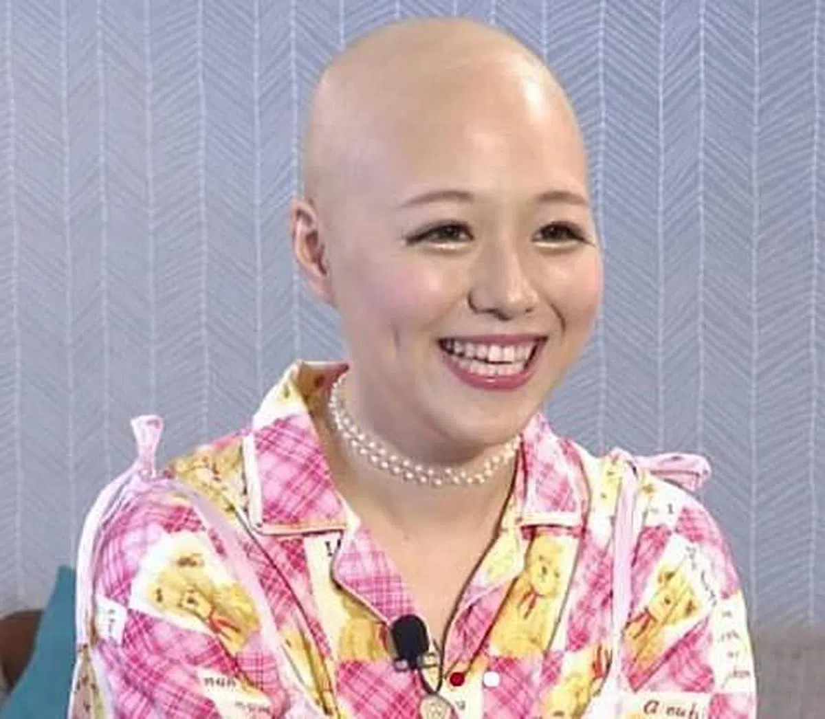 Pippi患上泛发性脱毛症。
