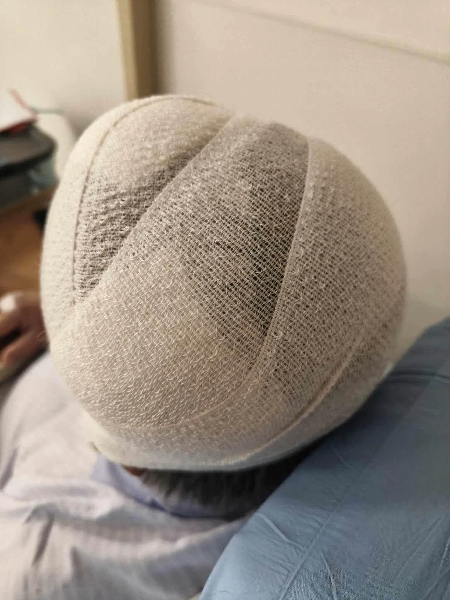 天花板塌落造成65岁男子头部、肩膀和膝盖受伤，头部缝了10多针。（受访者提供）