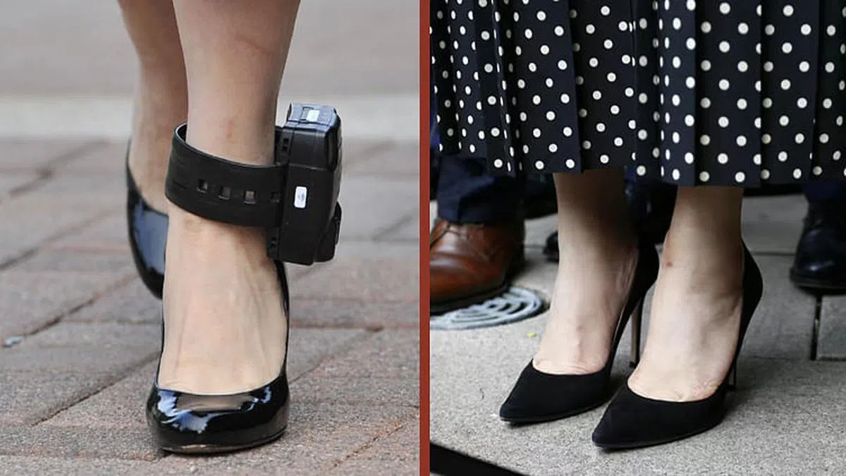 中国外交部发言人华春莹9月25日在推特贴出对比照片，显示孟晚舟腿上解除电子脚镣后的淤青。（华春莹推特）