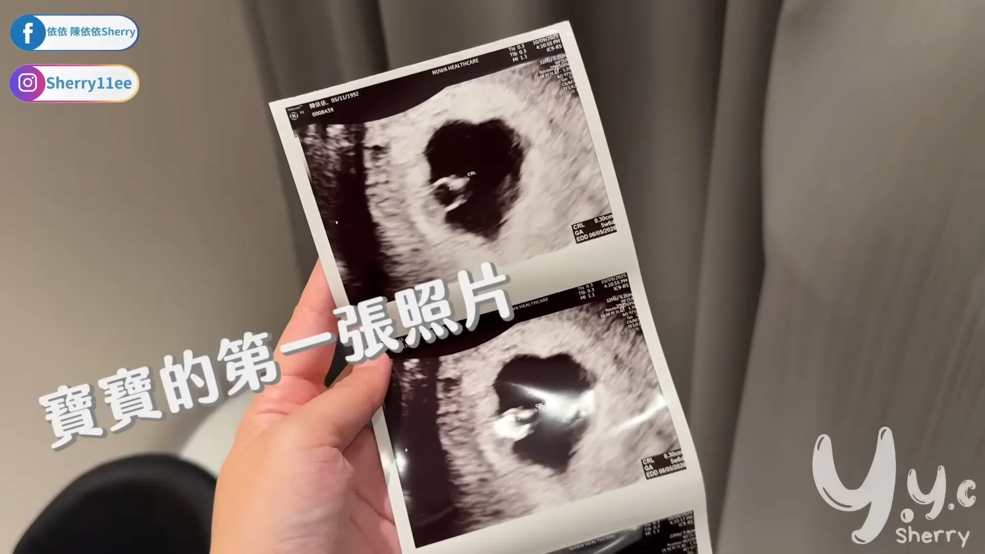 依依在视频炫出宝宝的“第一张照片”。（视频截图）