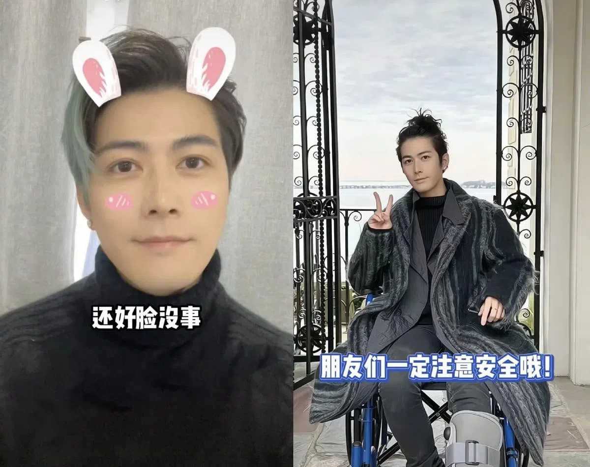 陈学冬幽默笑说“还好脸没事”。（互联网）