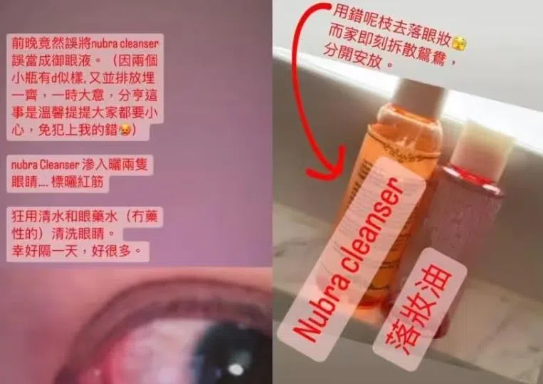 郑秀文在IG晒出眼白布满血丝的照片。（互联网）